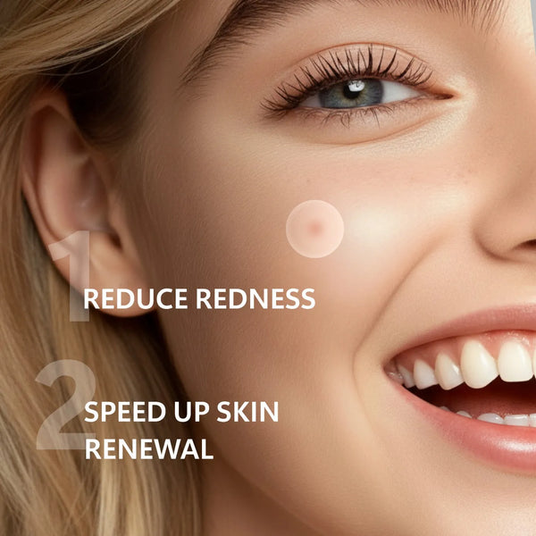 Overnight Blemish Busters