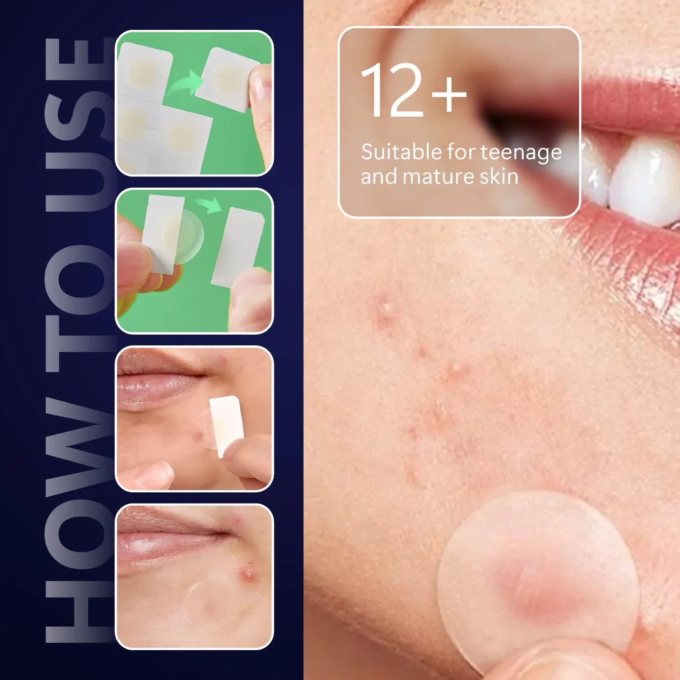 Overnight Blemish Busters