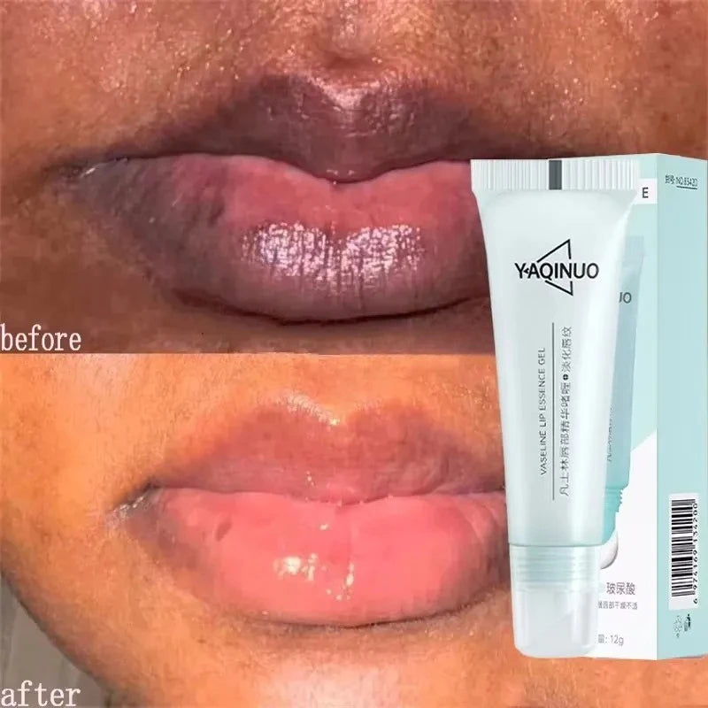 Remove Dark Lip Balm Fast Lightening Pink Lip Exfoliating Fade Lip Line Dead Skin Moisturizer Korean Care Products Beauty Health