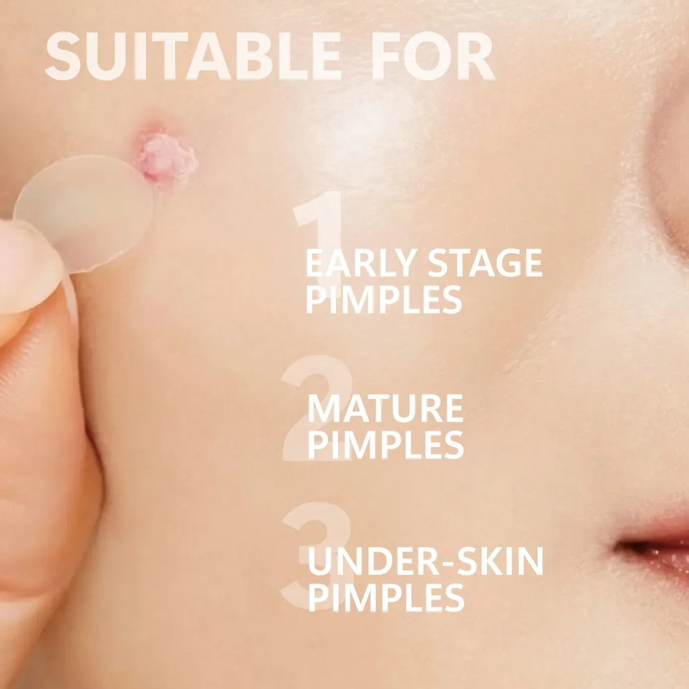 Overnight Blemish Busters