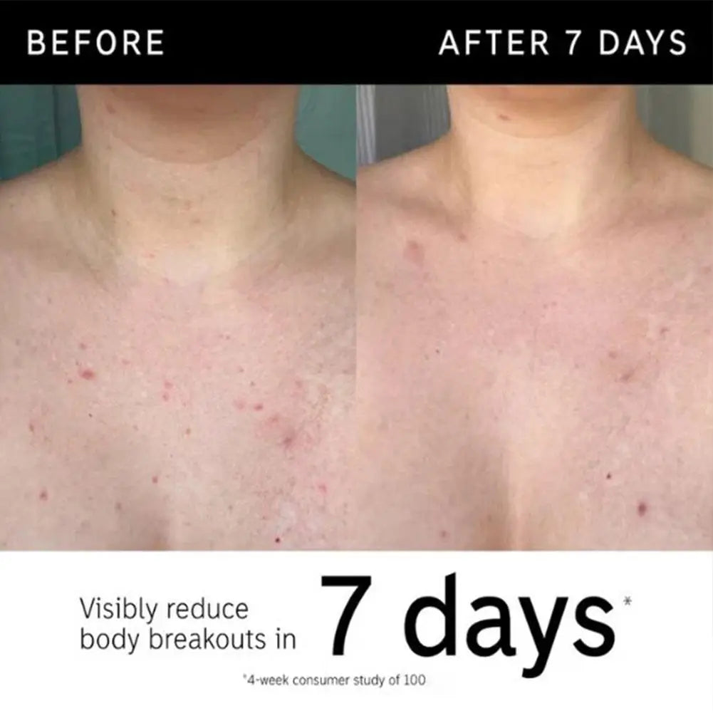 Glow Boost Exfoliating Stick